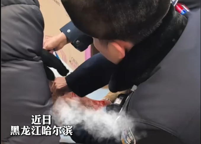 男子突發血管破裂!民警幫忙包扎止血