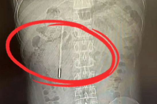 ����һ����12��ʱ����ˮ���¶ȼƣ��°����˵��������20�������ȡ��